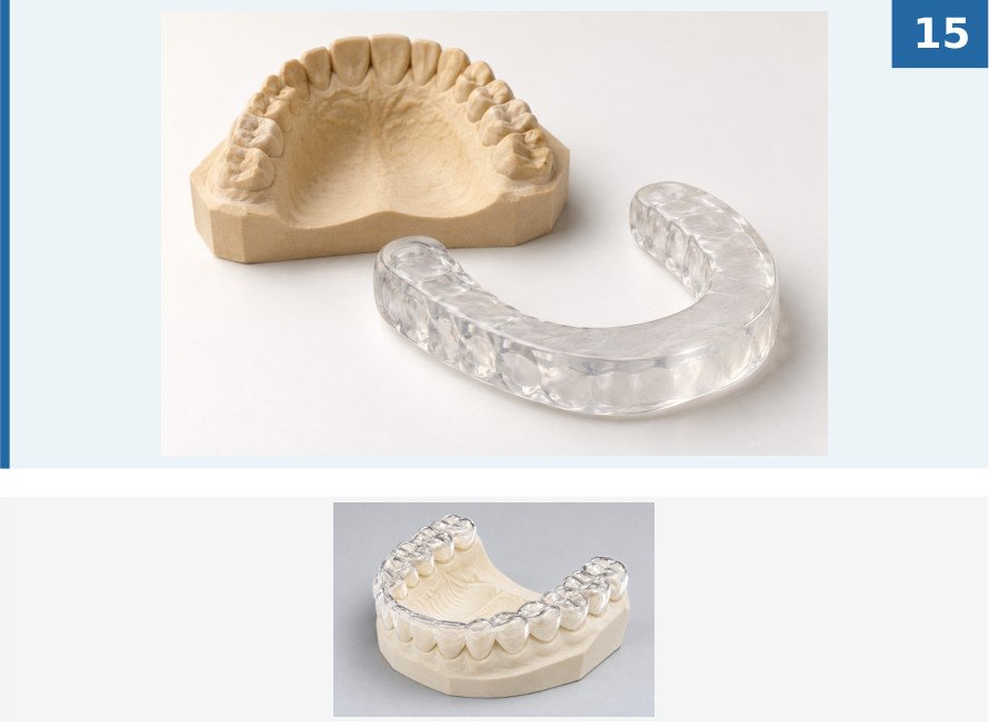 Occlusal relaxation splint