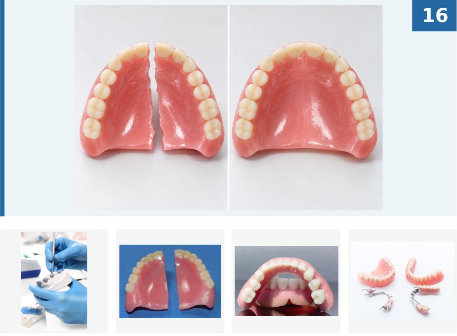 Denture repair