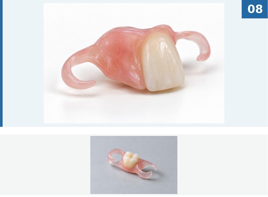 Flexible clip · 1–3 teeth